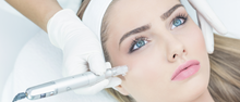Load image into Gallery viewer, 3 Microneedling Package